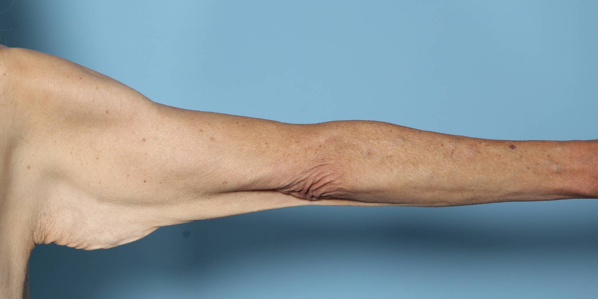 Before & After Image