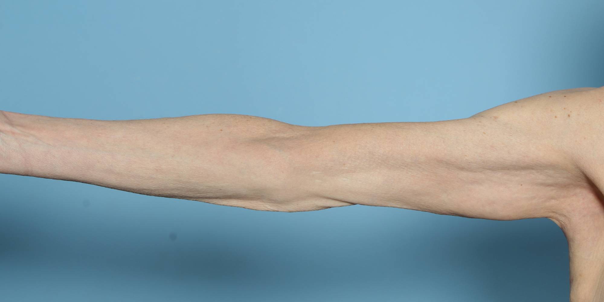 Before & After Image