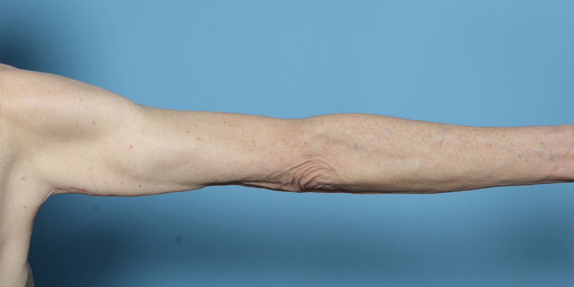 Before & After Image