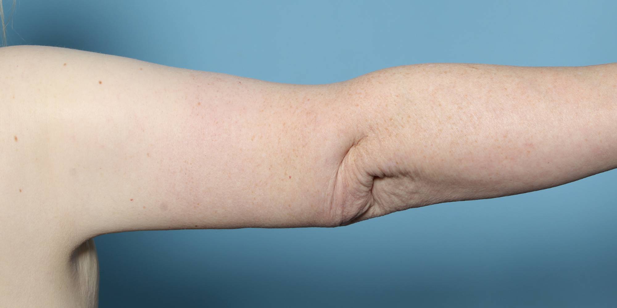 Before & After Image