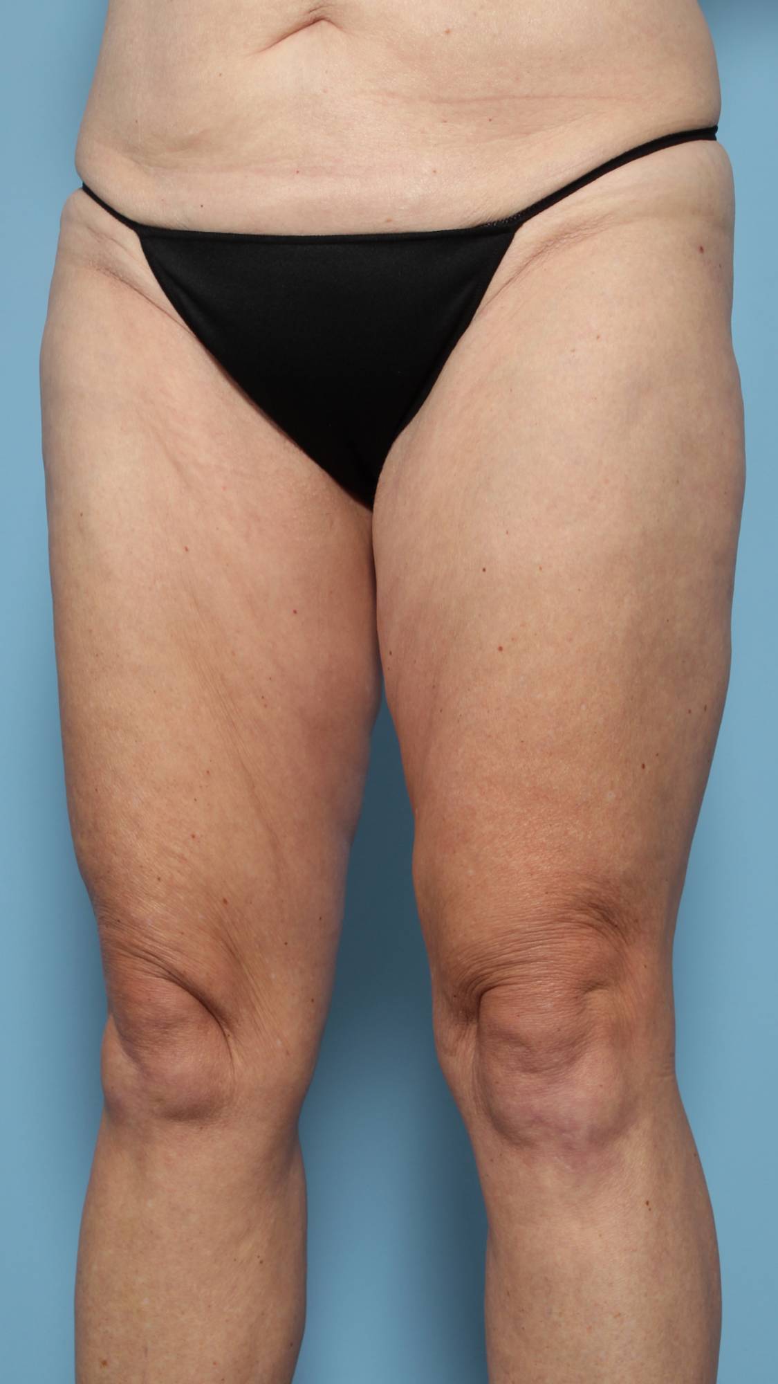 Before & After Image