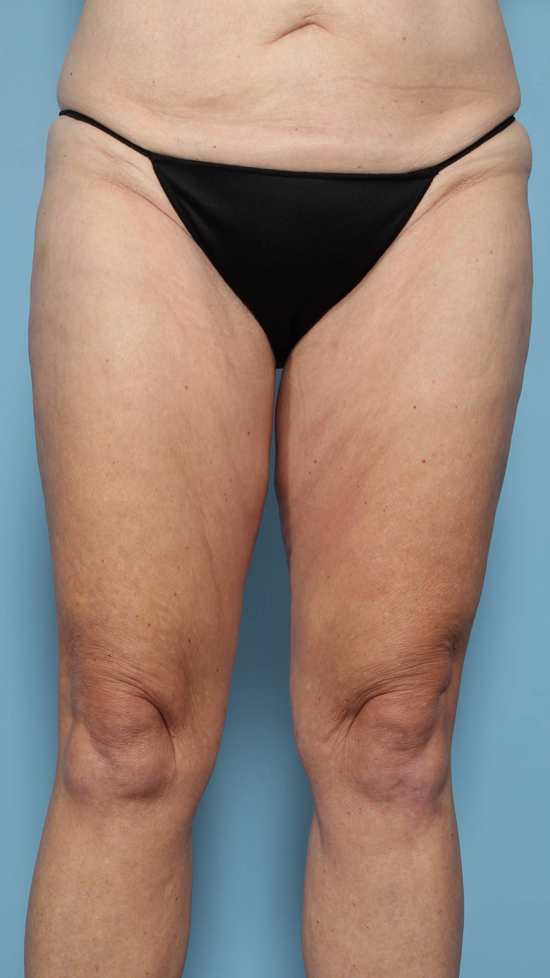 Before & After Image