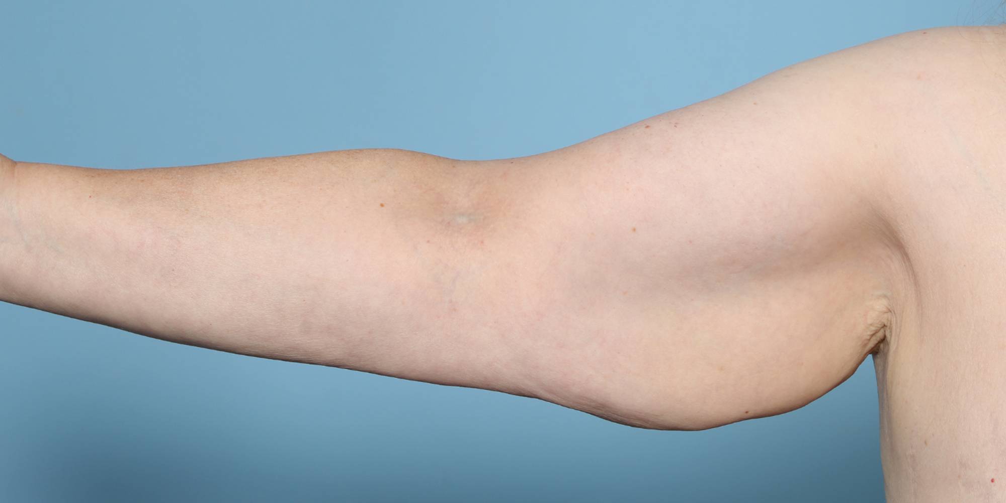 Before & After Image