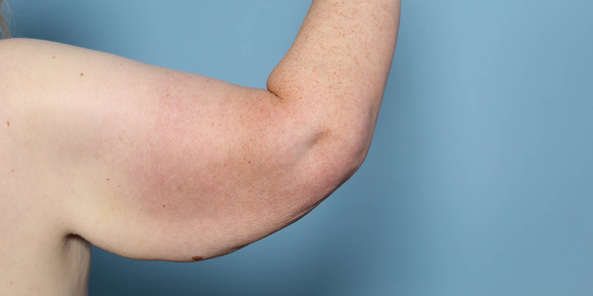 Before & After Image