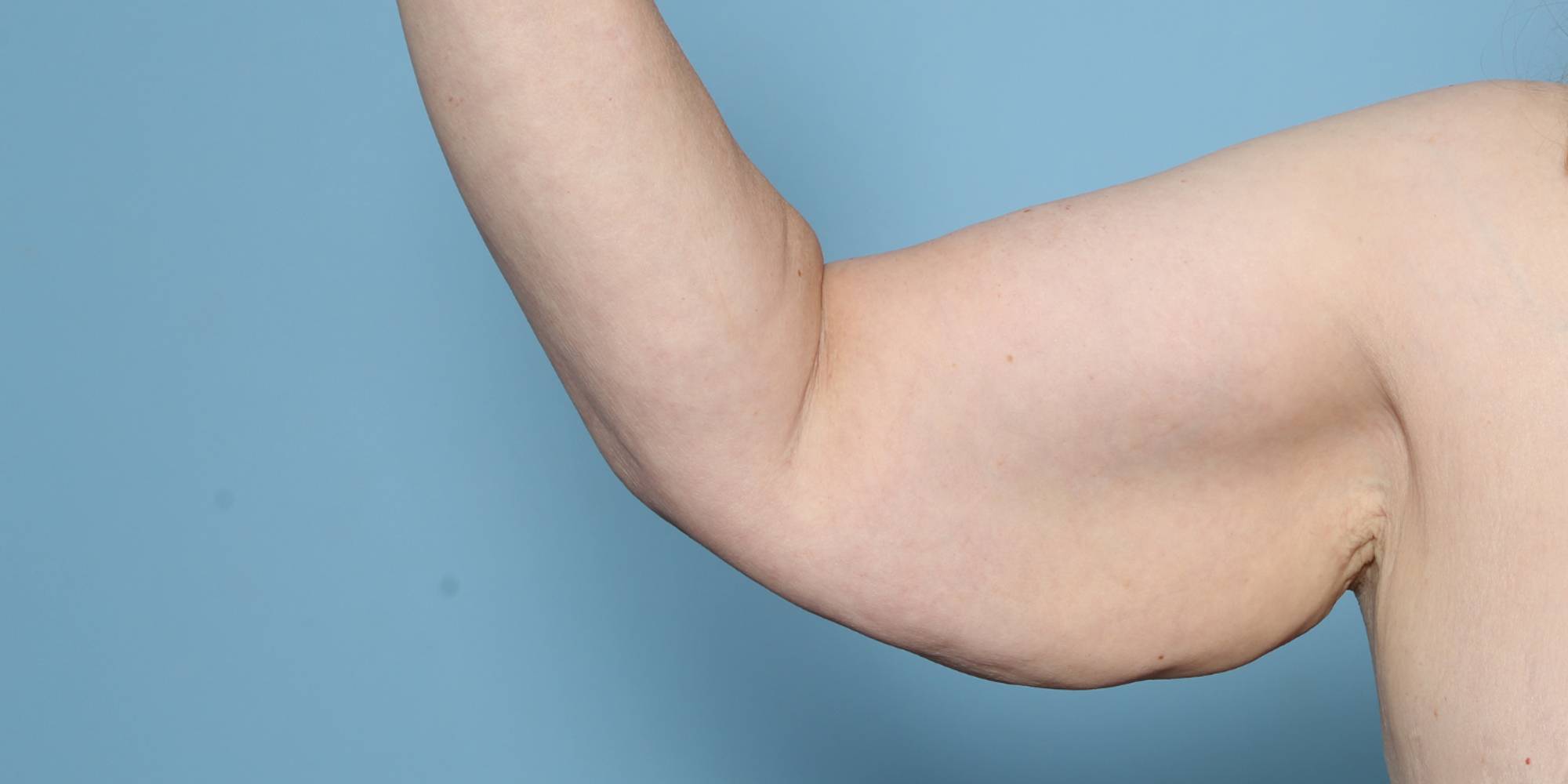 Before & After Image