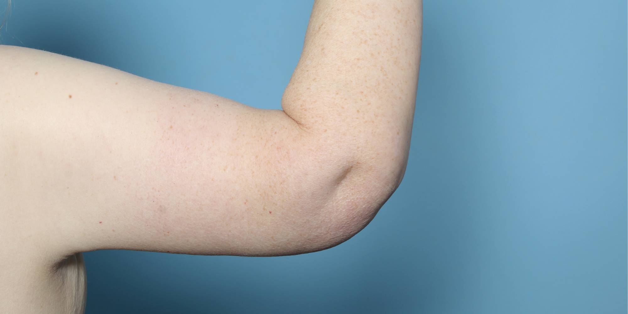 Before & After Image