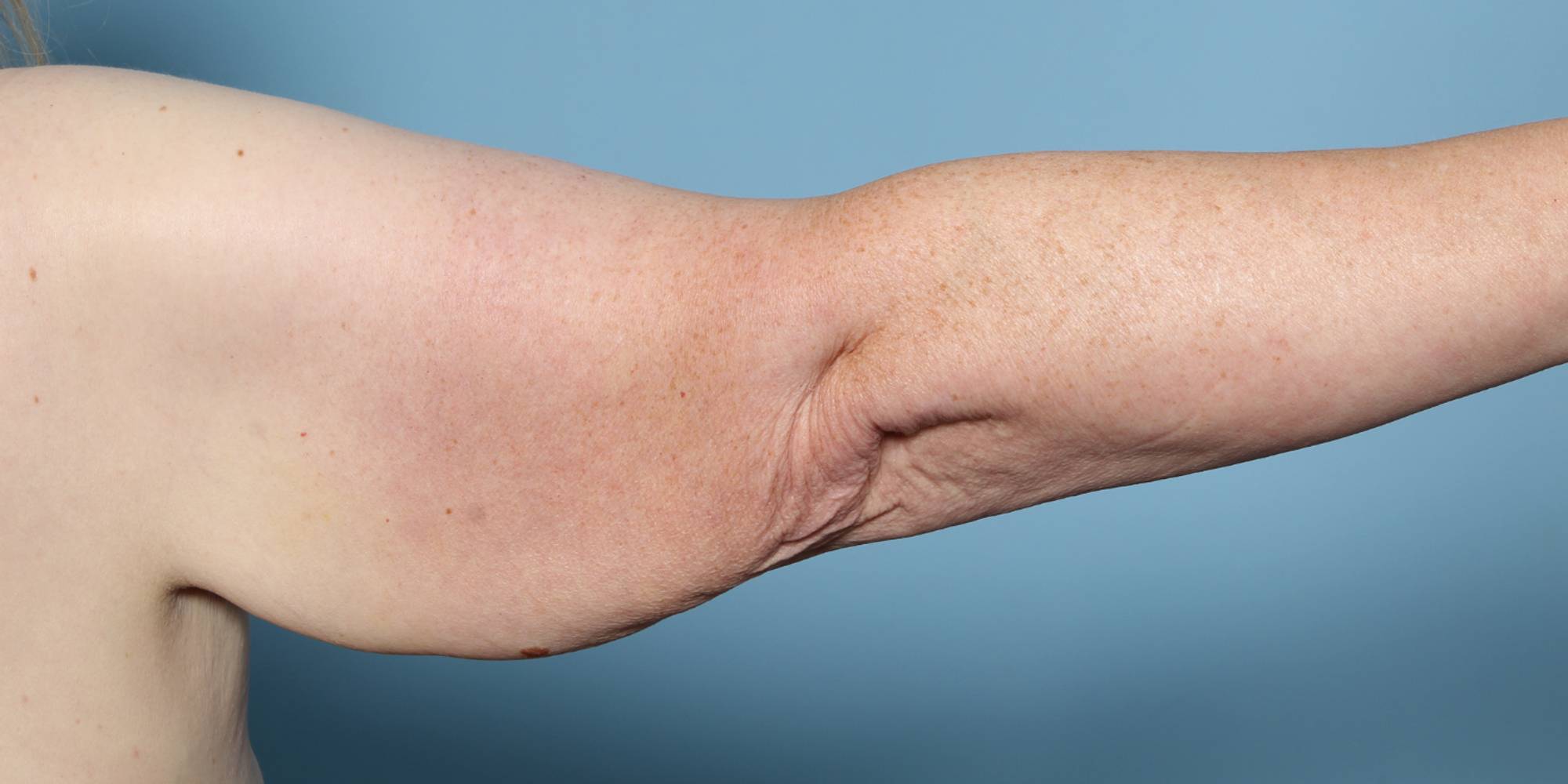 Before & After Image