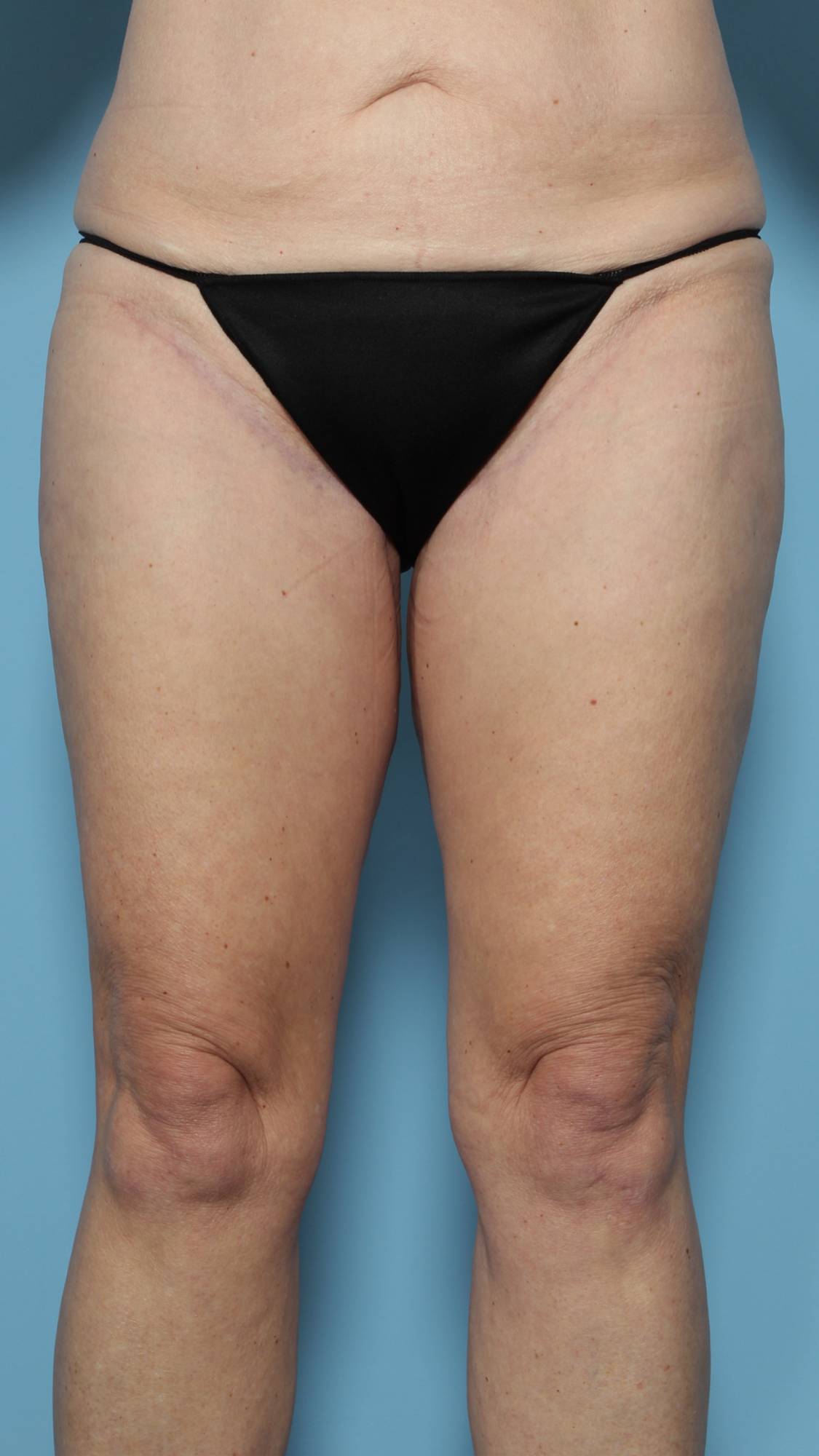 Before & After Image