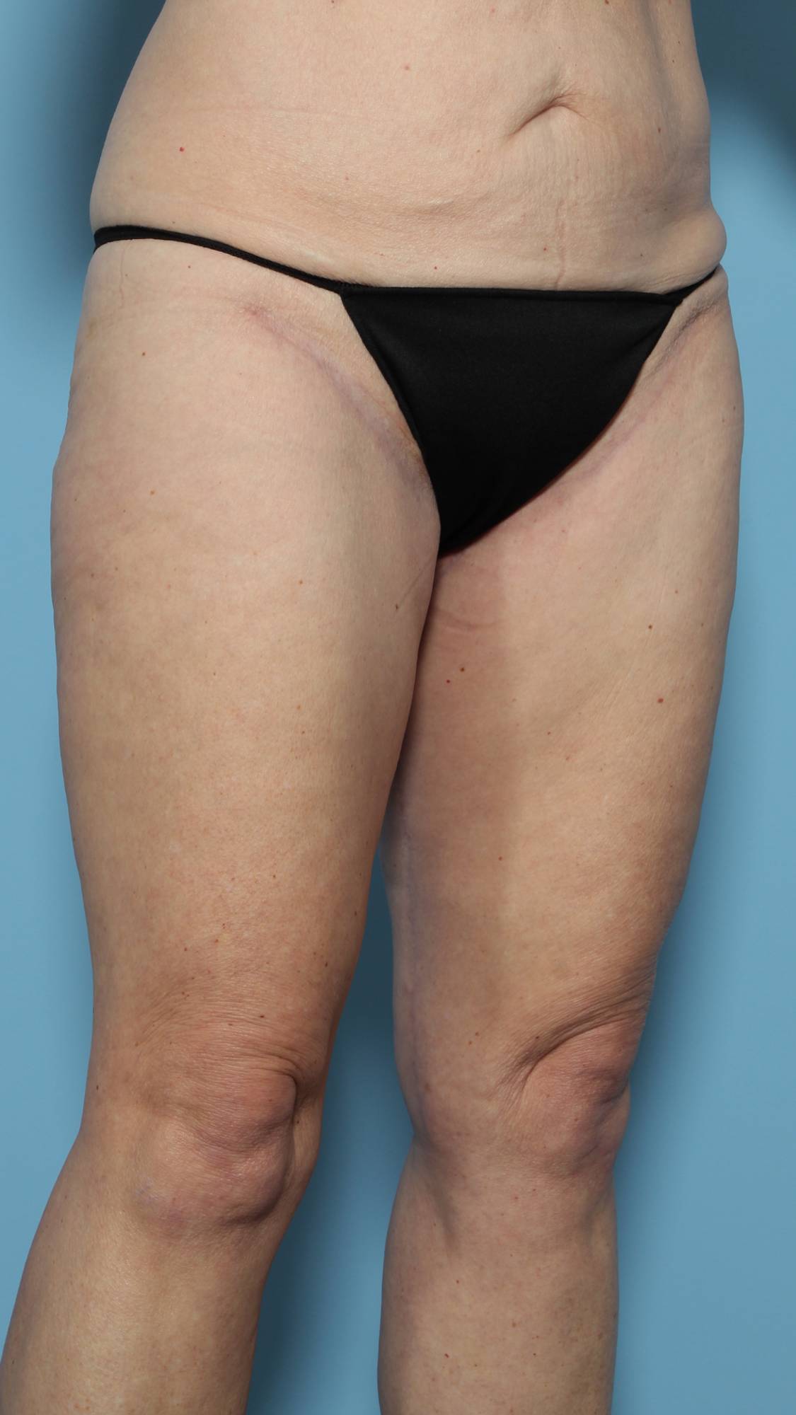 Before & After Image