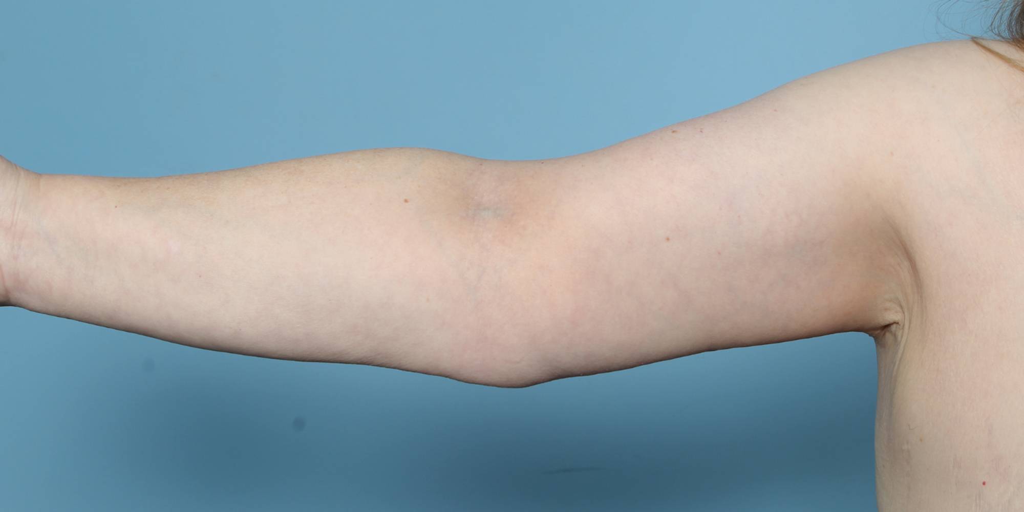 Before & After Image