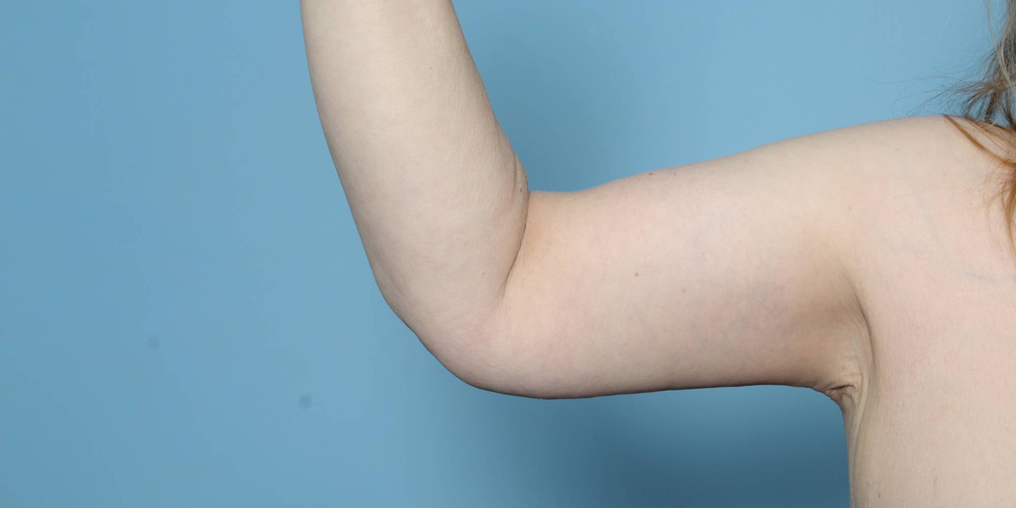 Before & After Image