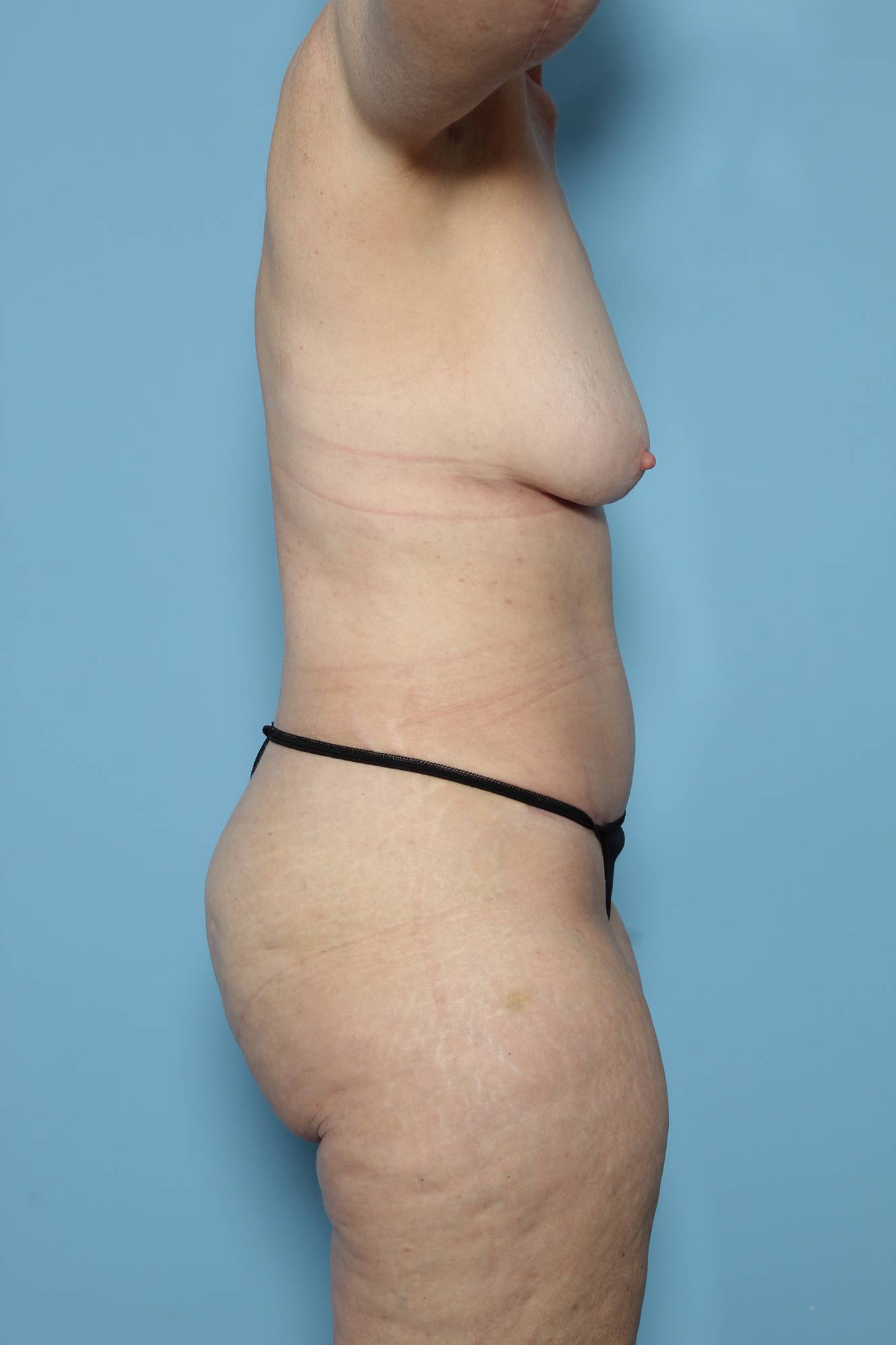 Before & After Image