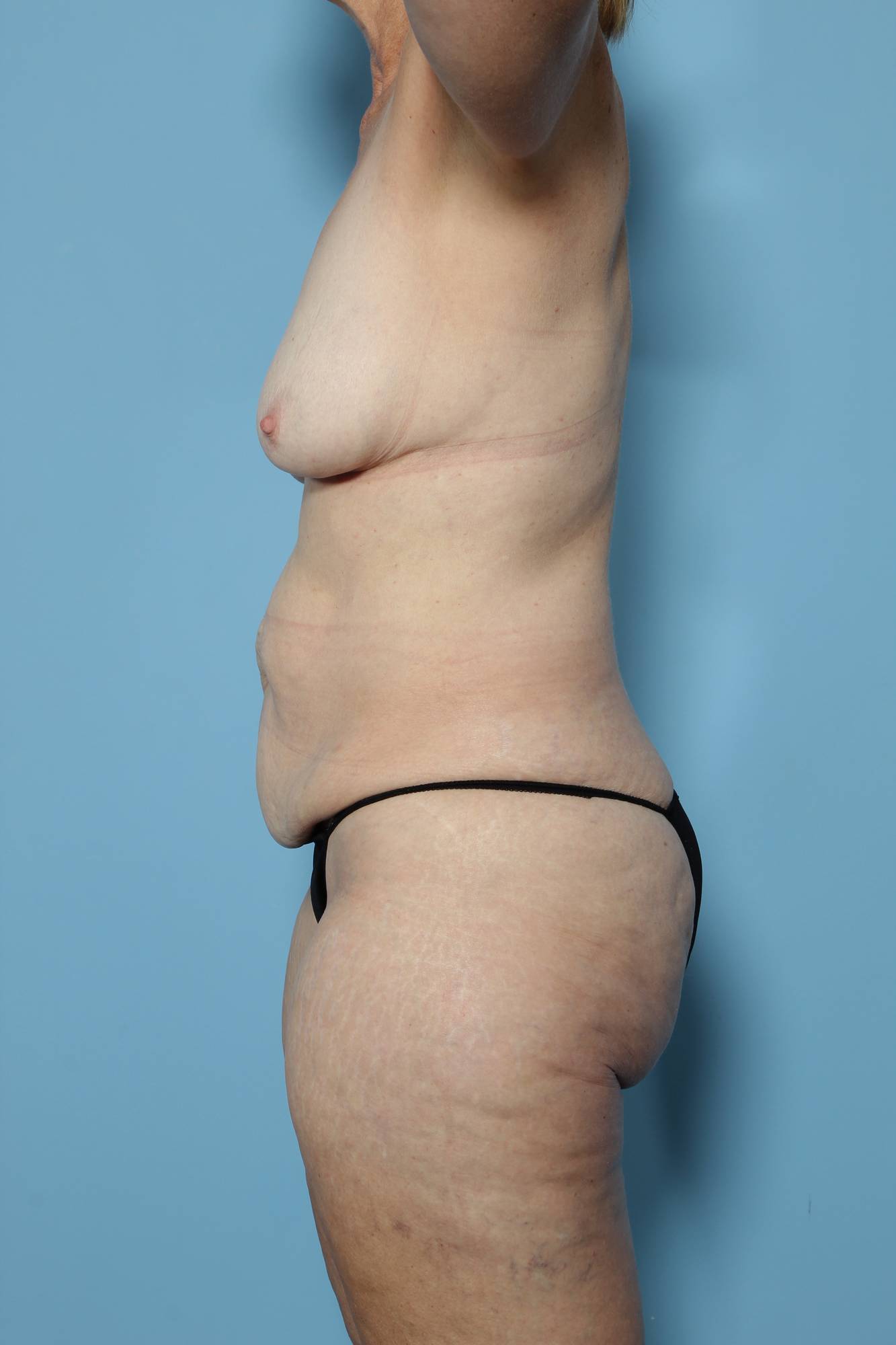 Before & After Image