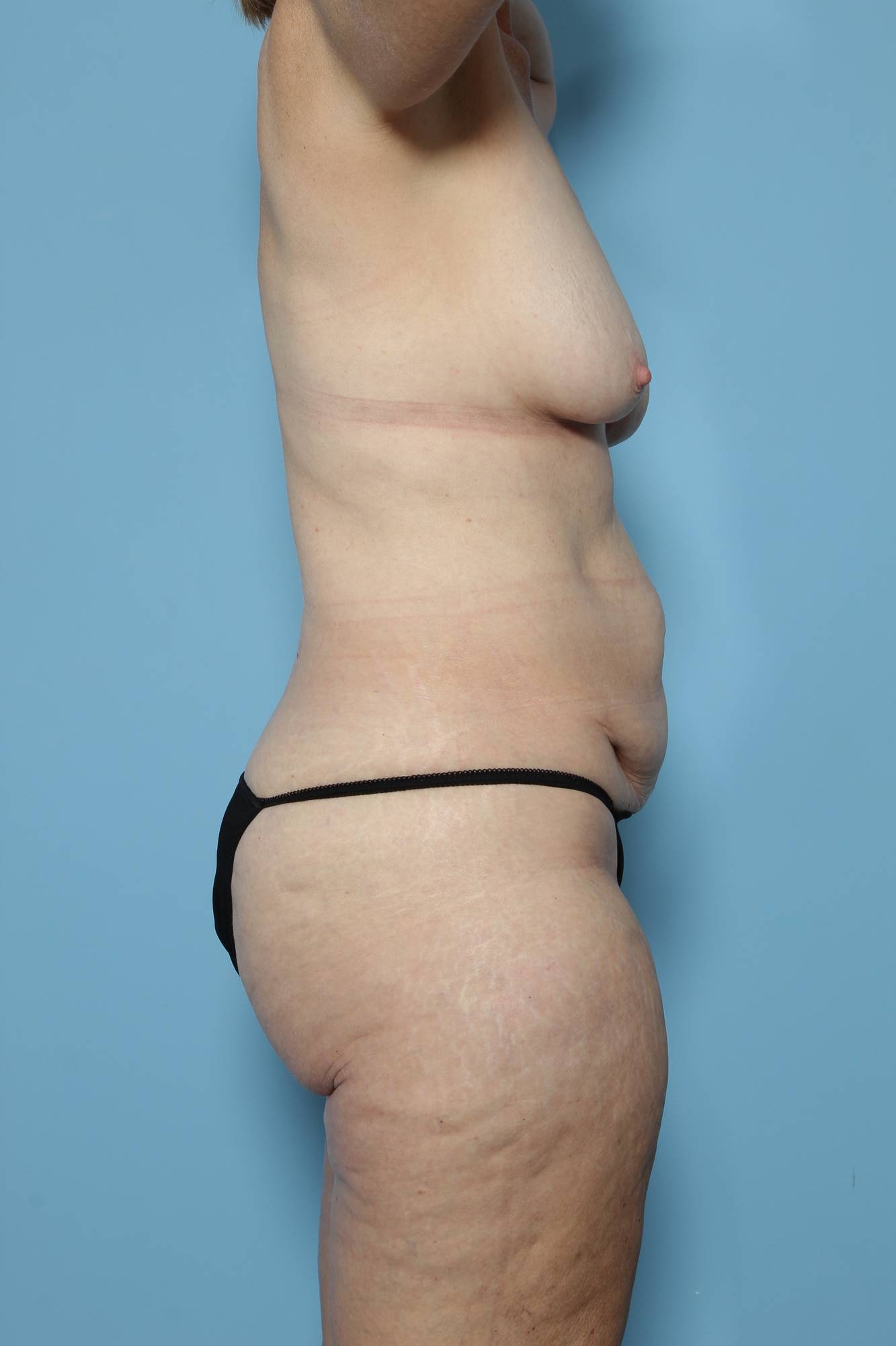 Before & After Image