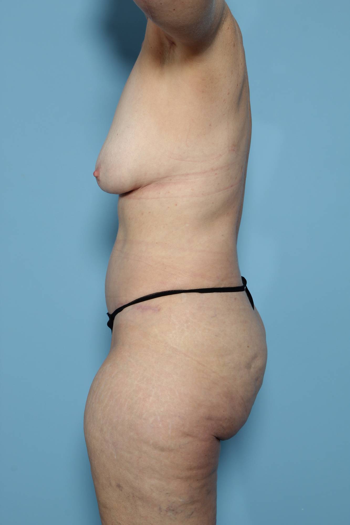 Before & After Image