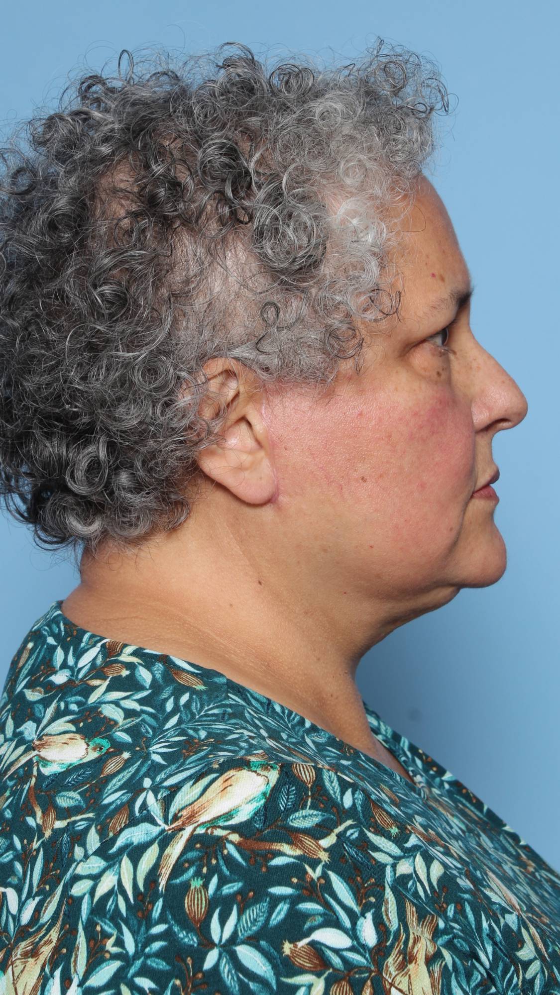 Before & After Image