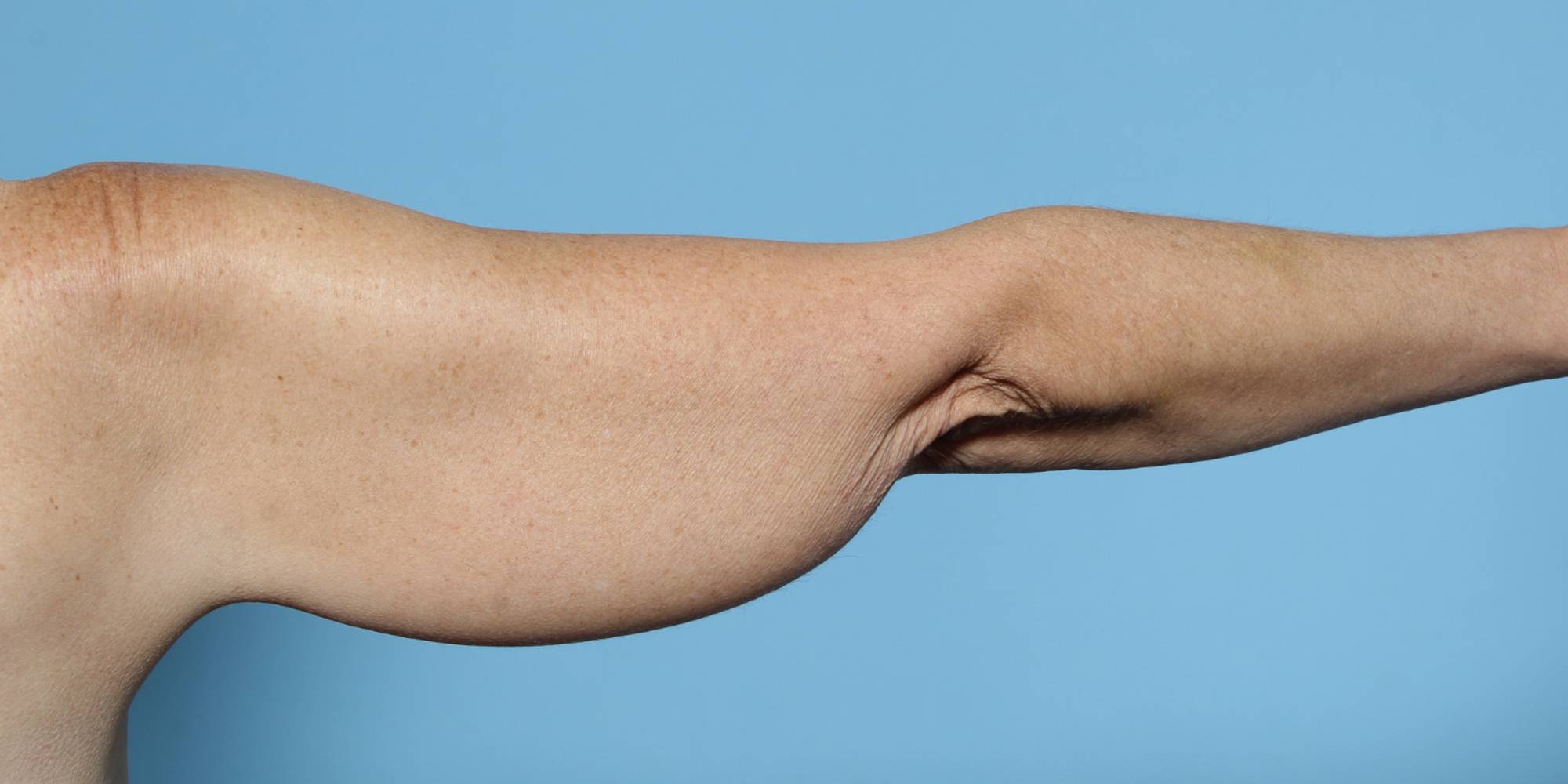 Before & After Image