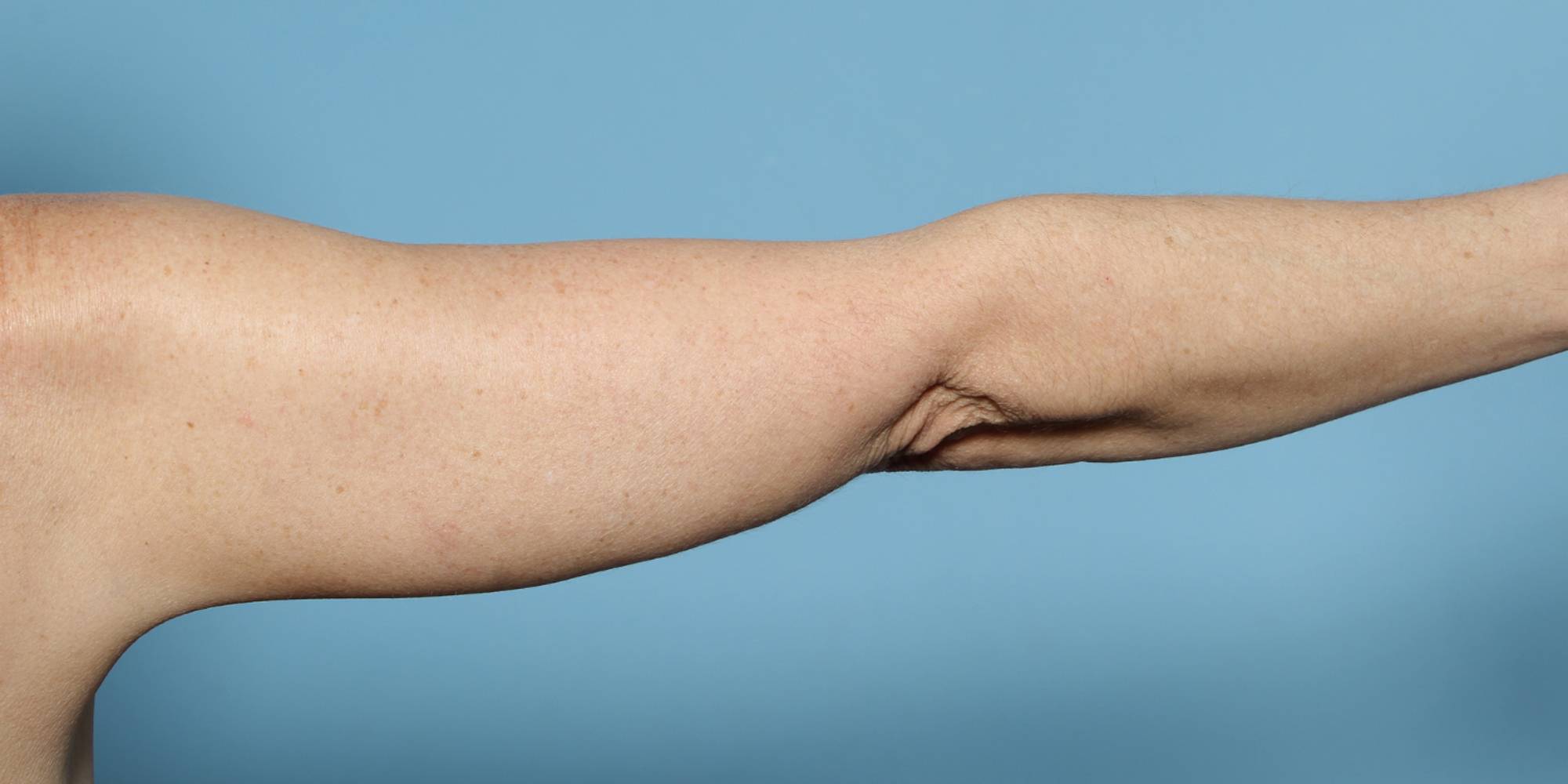 Before & After Image