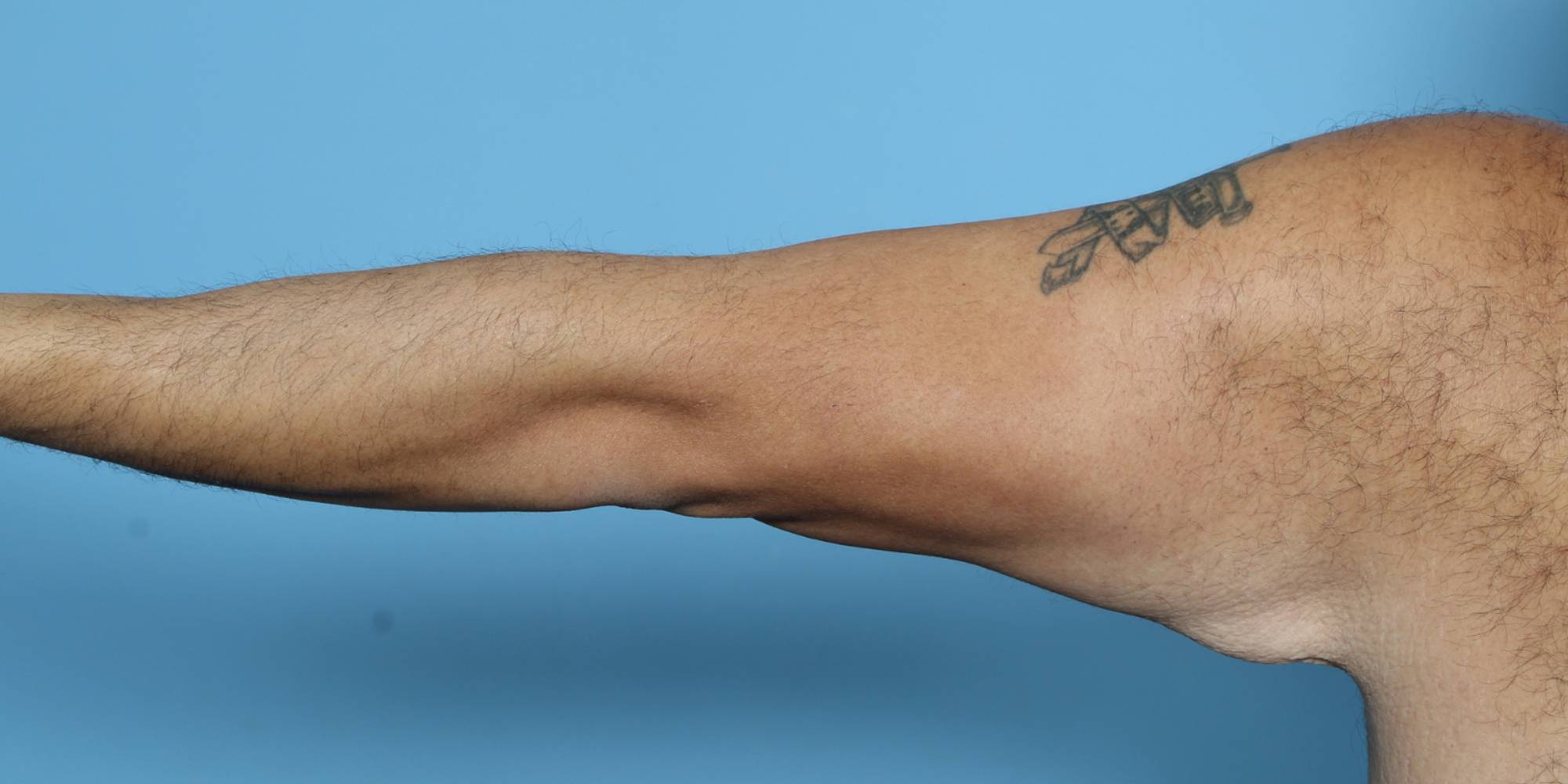 Before & After Image