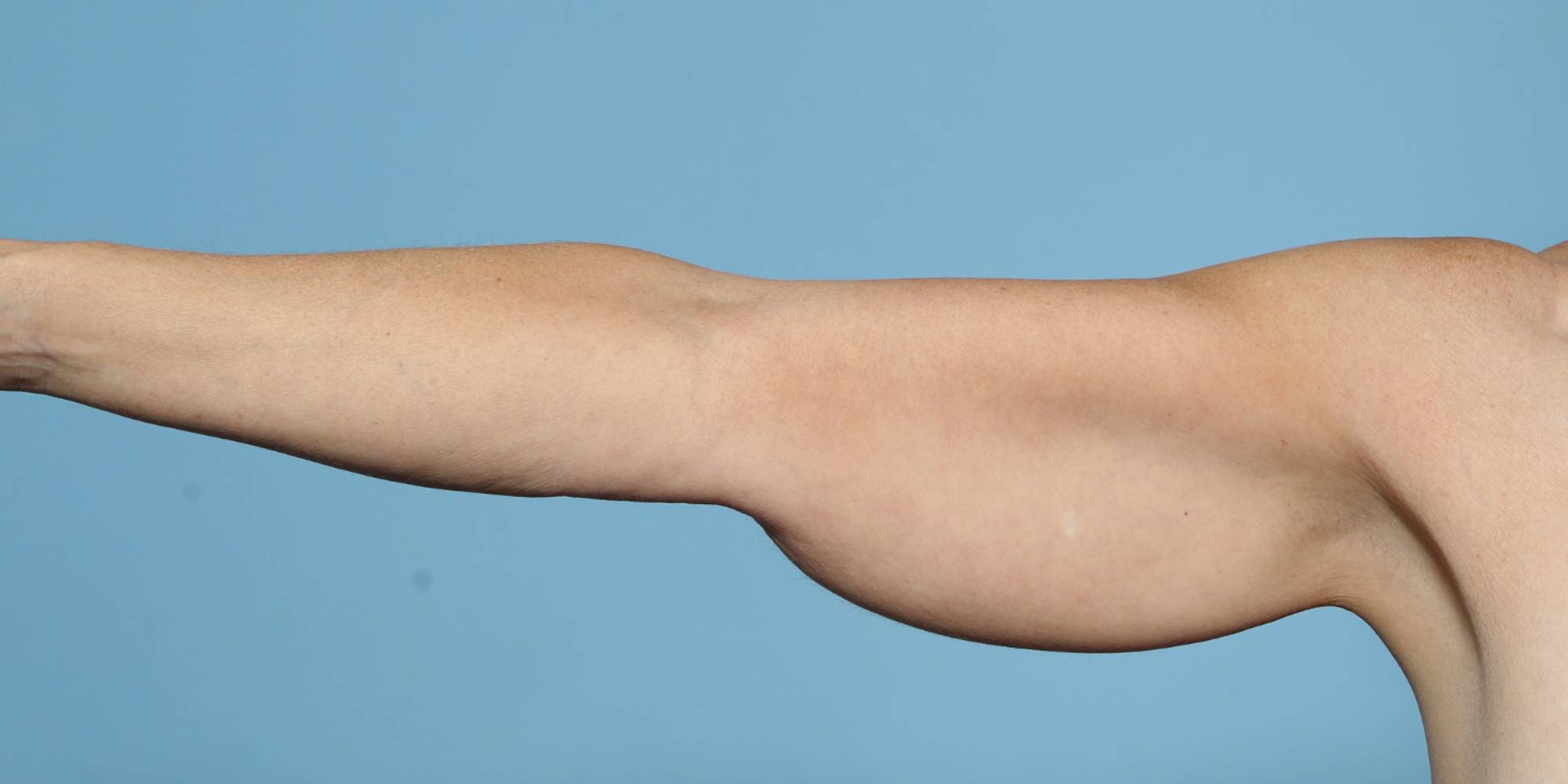 Before & After Image