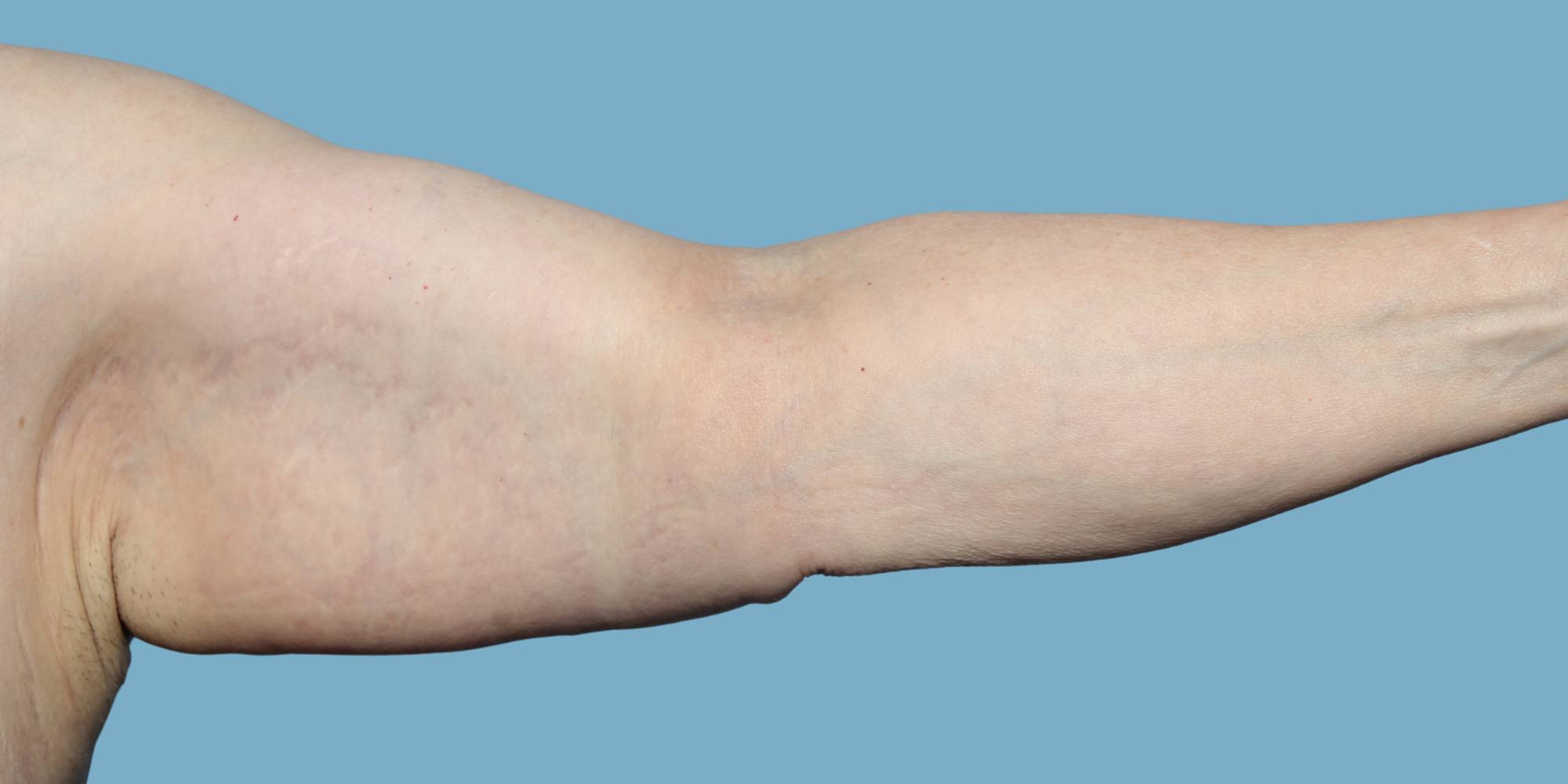 Before & After Image