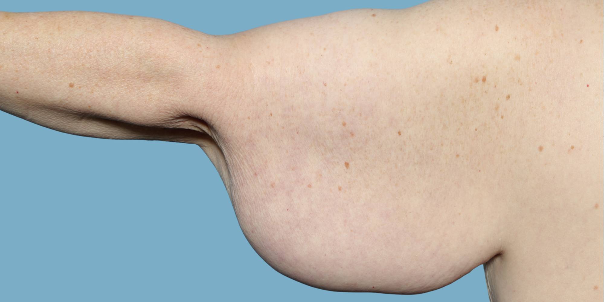 Before & After Image