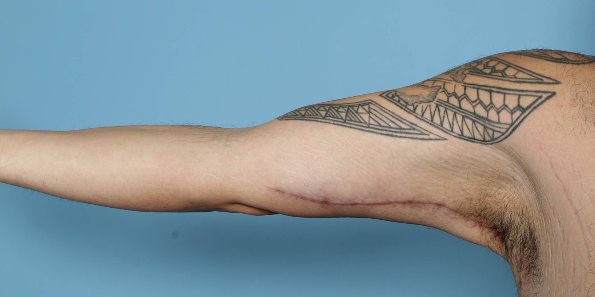 Before & After Image