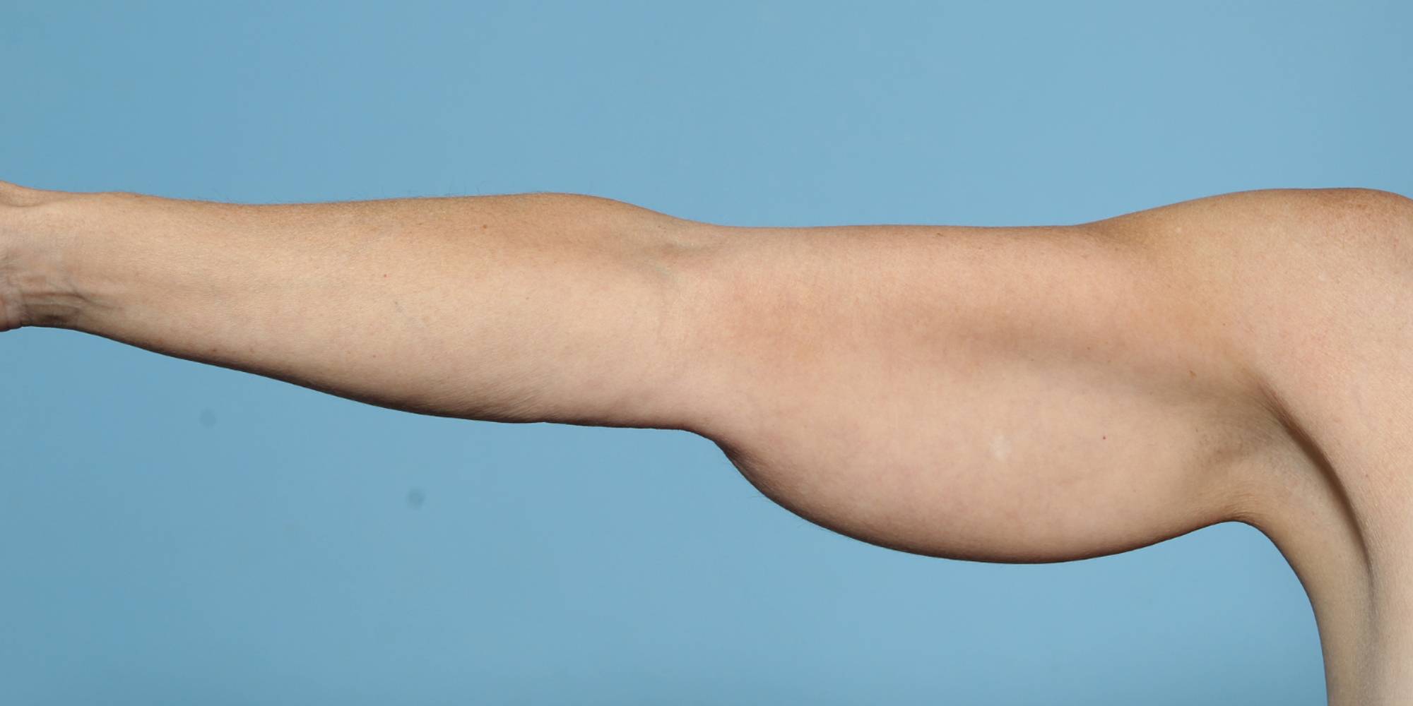 Before & After Image