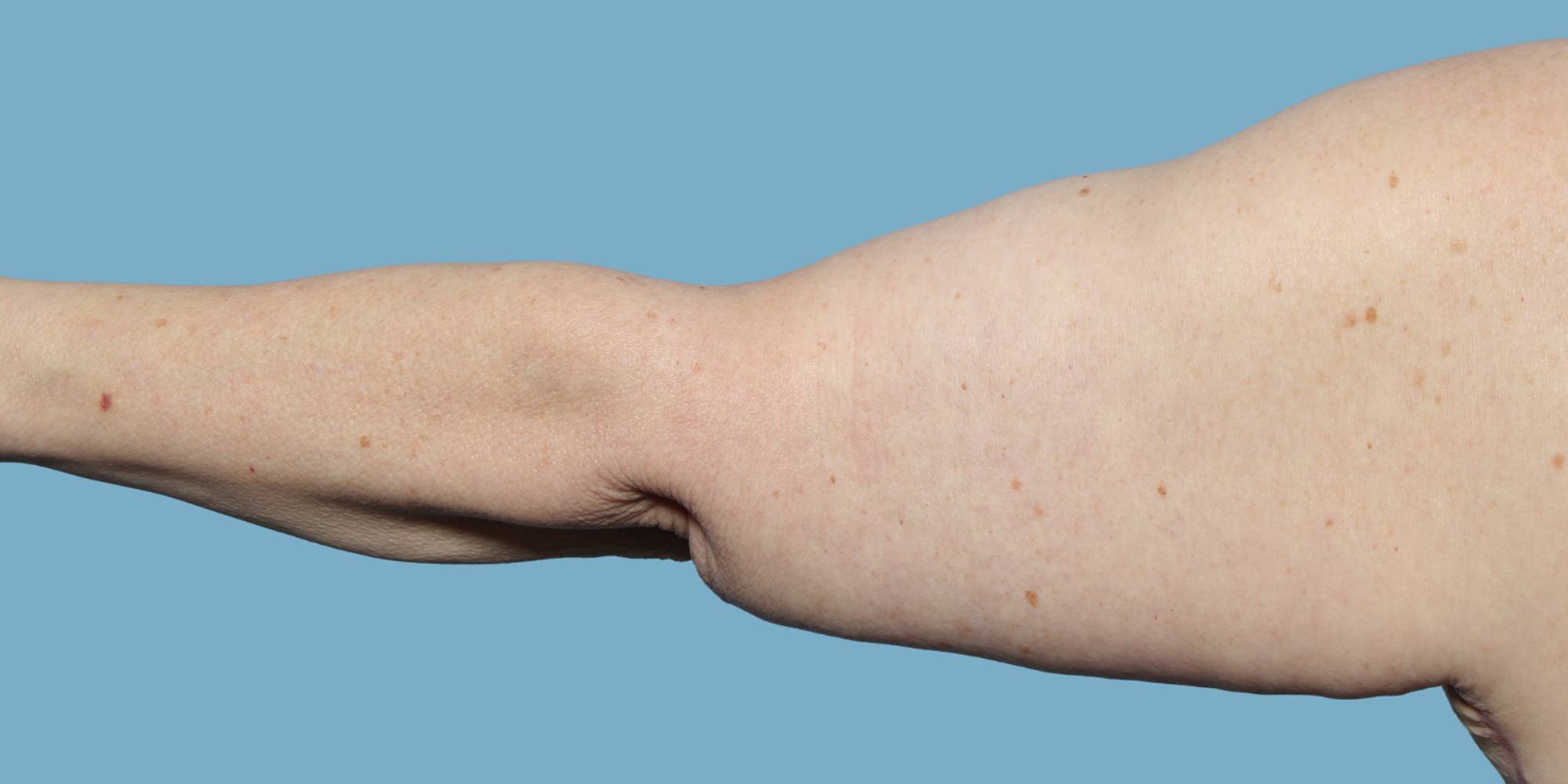 Before & After Image