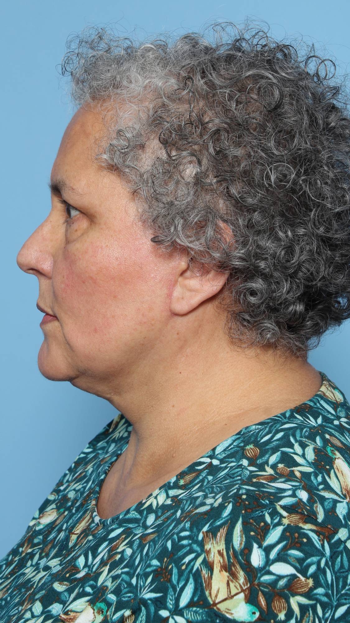 Before & After Image