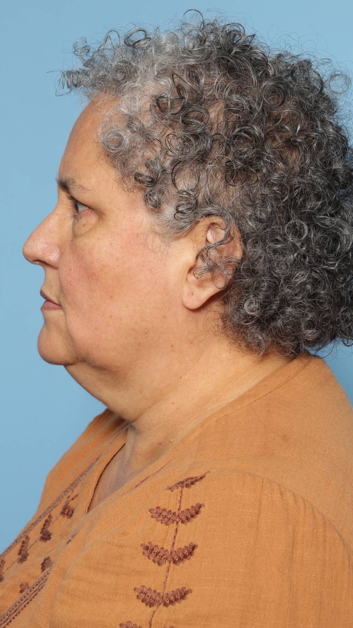 Before & After Image