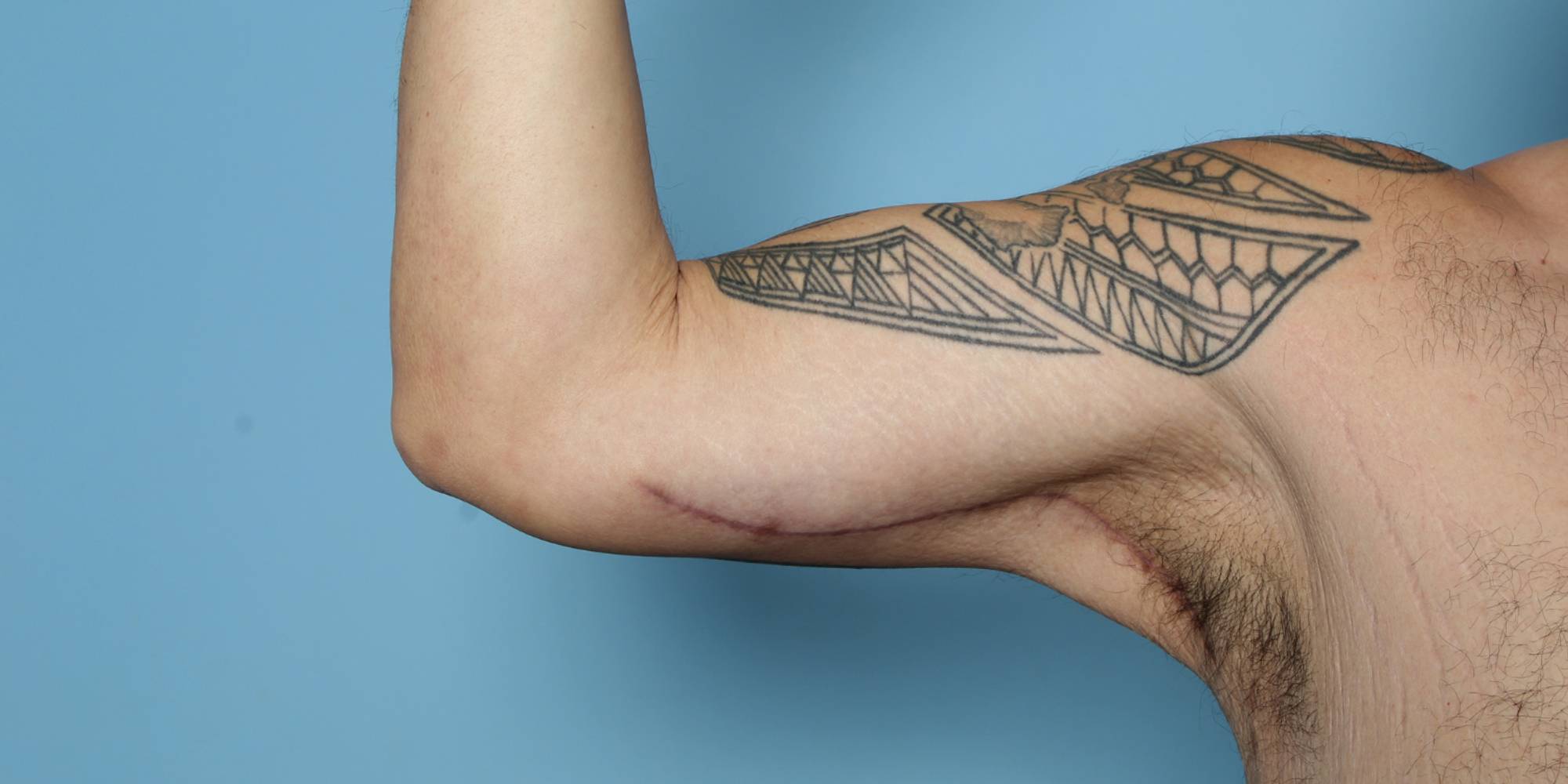 Before & After Image