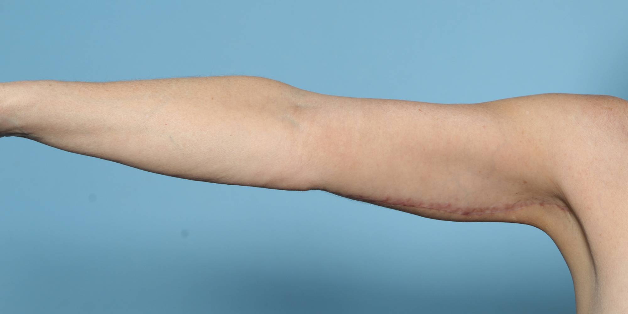 Before & After Image