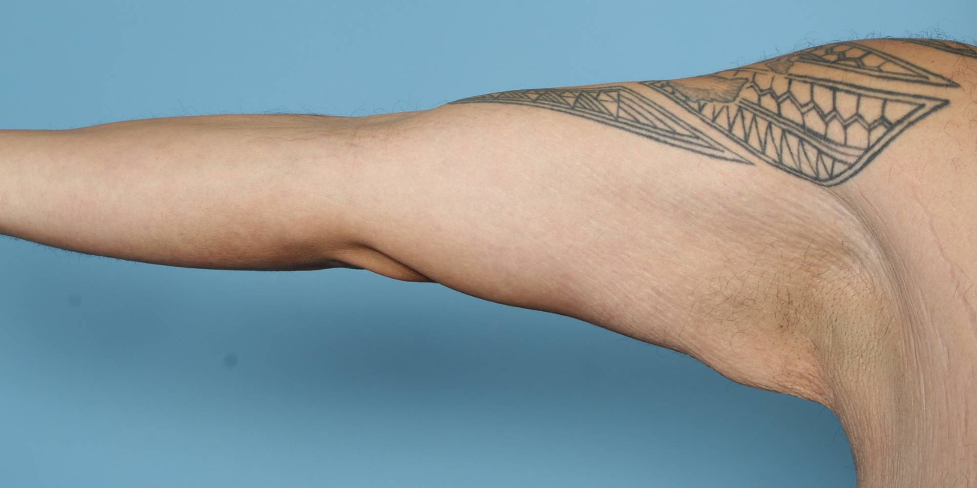 Before & After Image