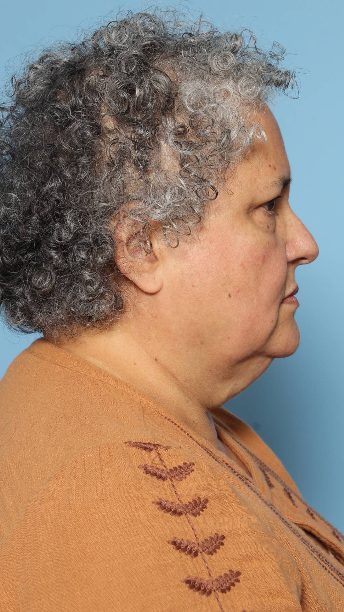 Before & After Image