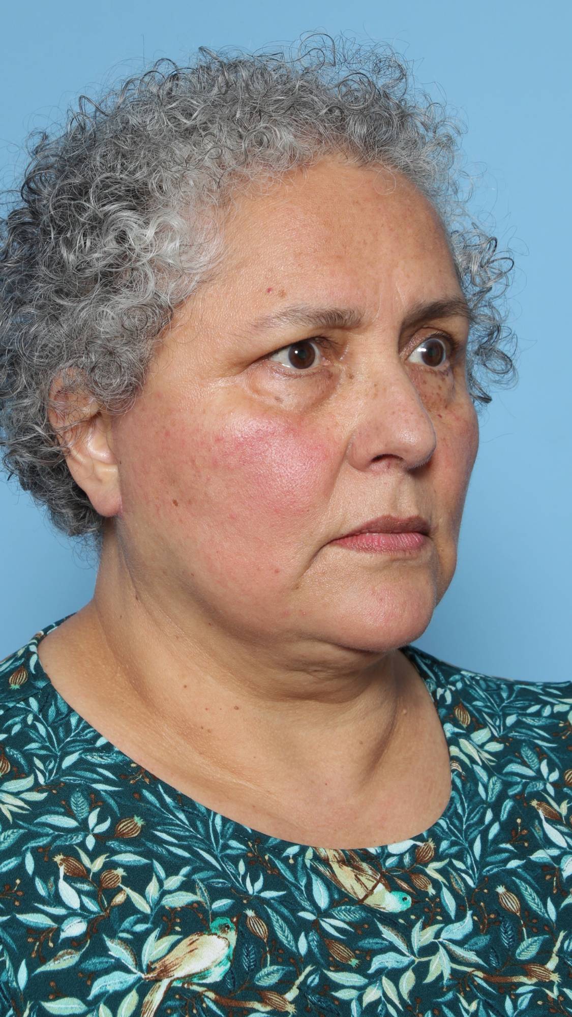 Before & After Image