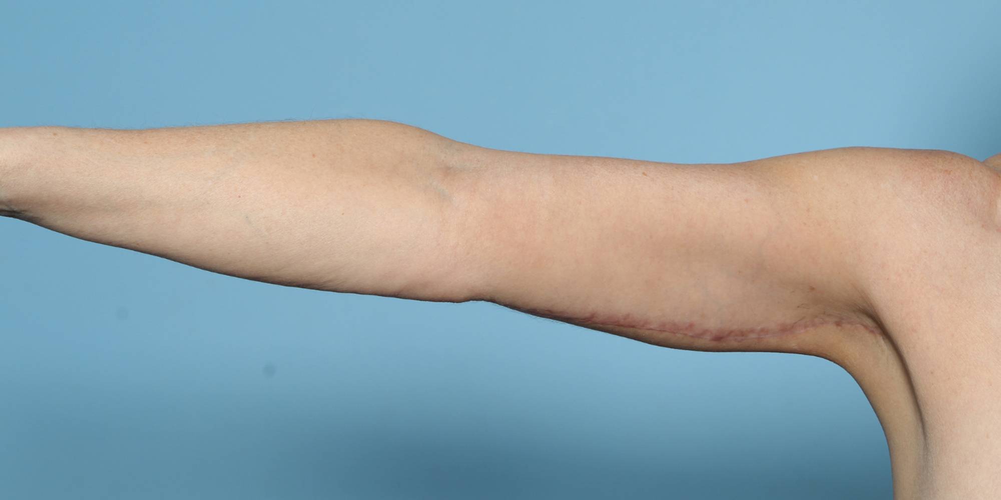 Before & After Image