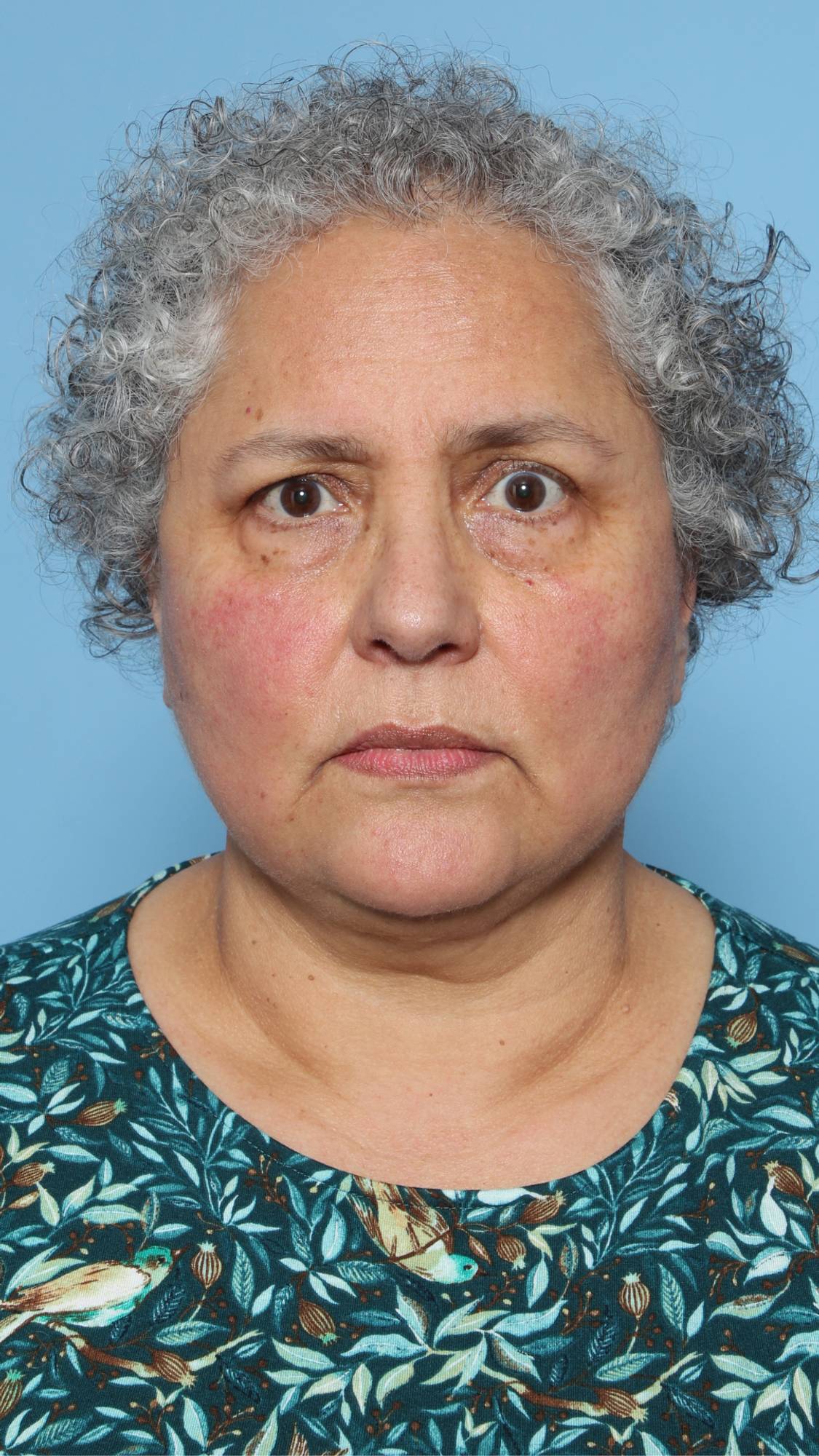 Before & After Image