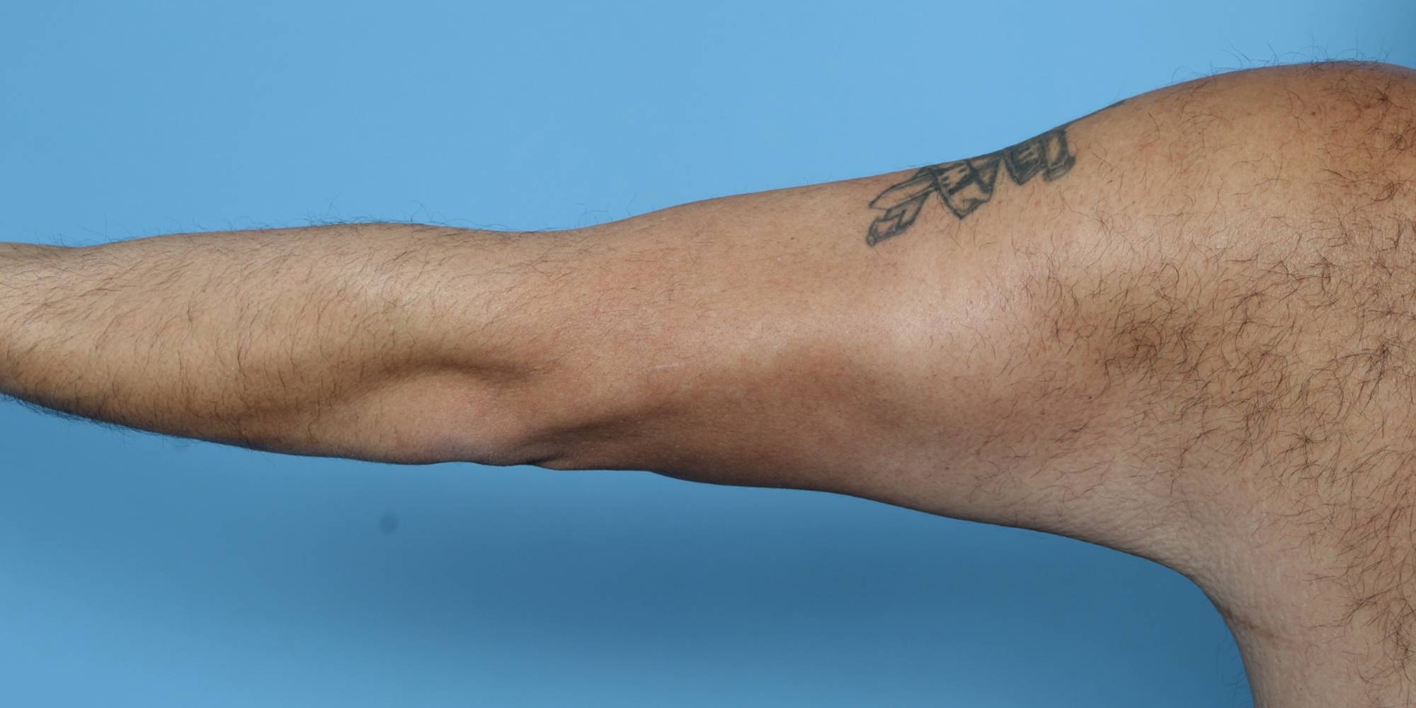 Before & After Image