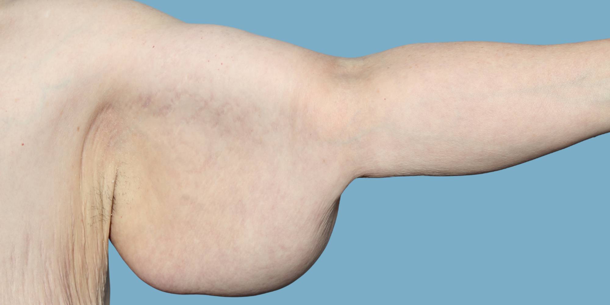 Before & After Image