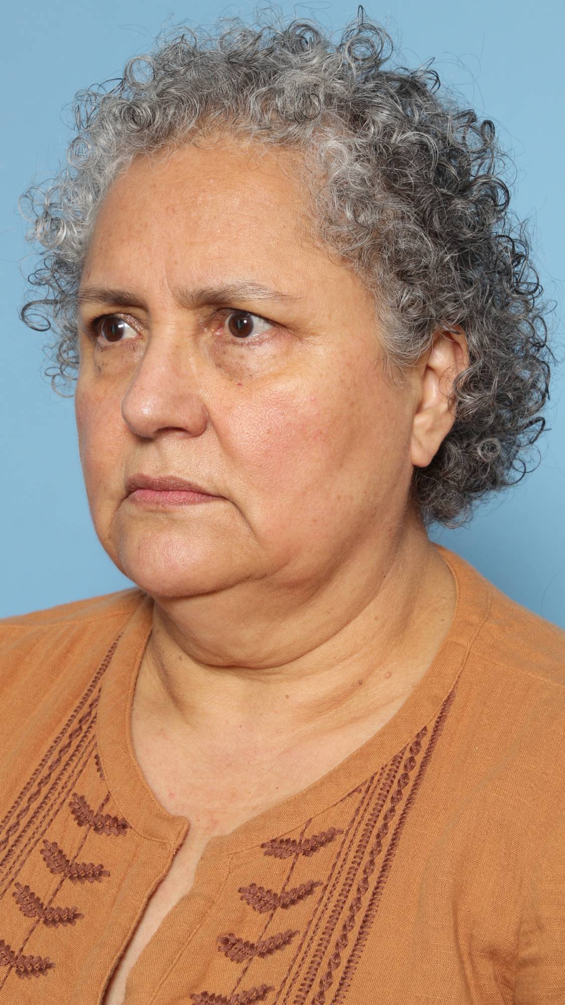 Before & After Image