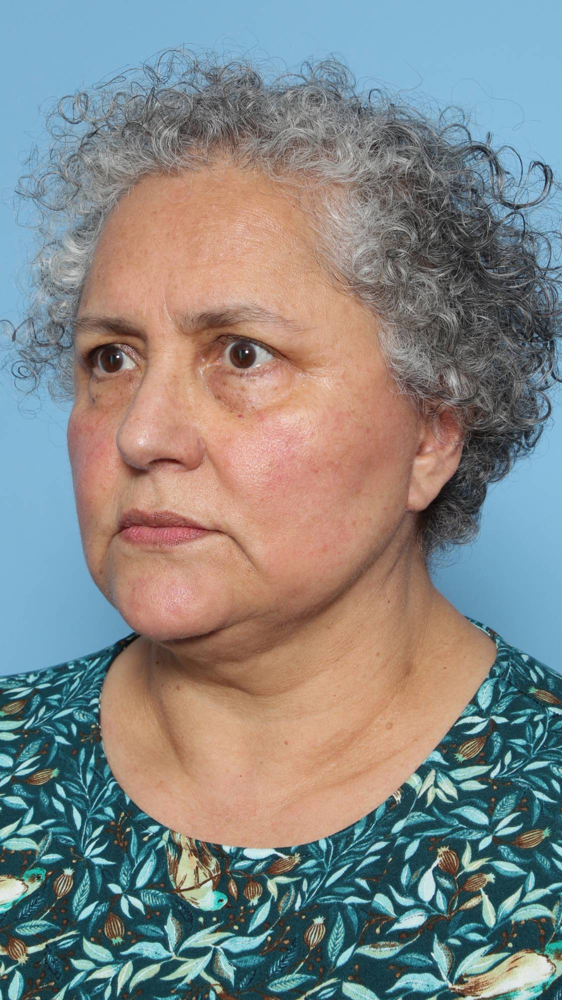 Before & After Image