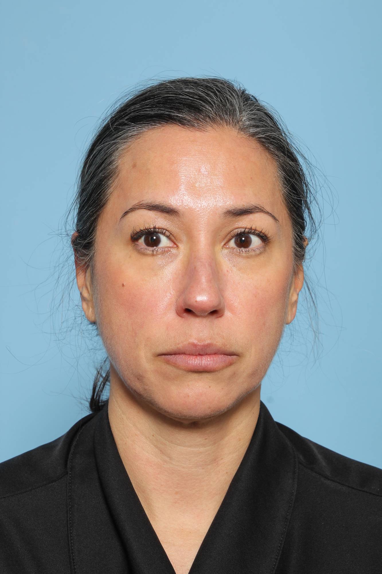 Before & After Image