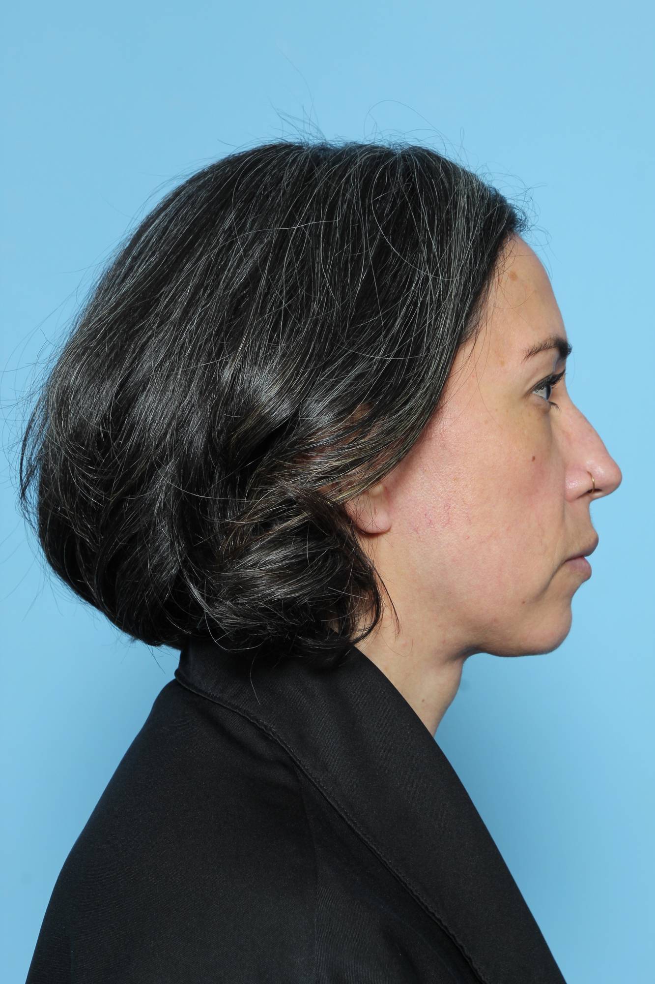 Before & After Image