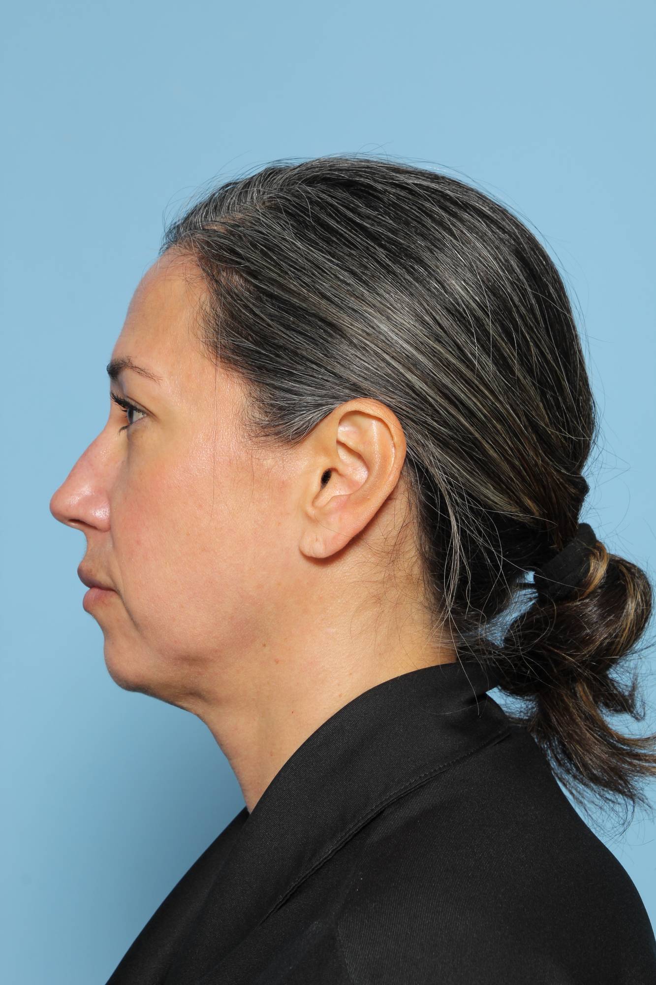 Before & After Image