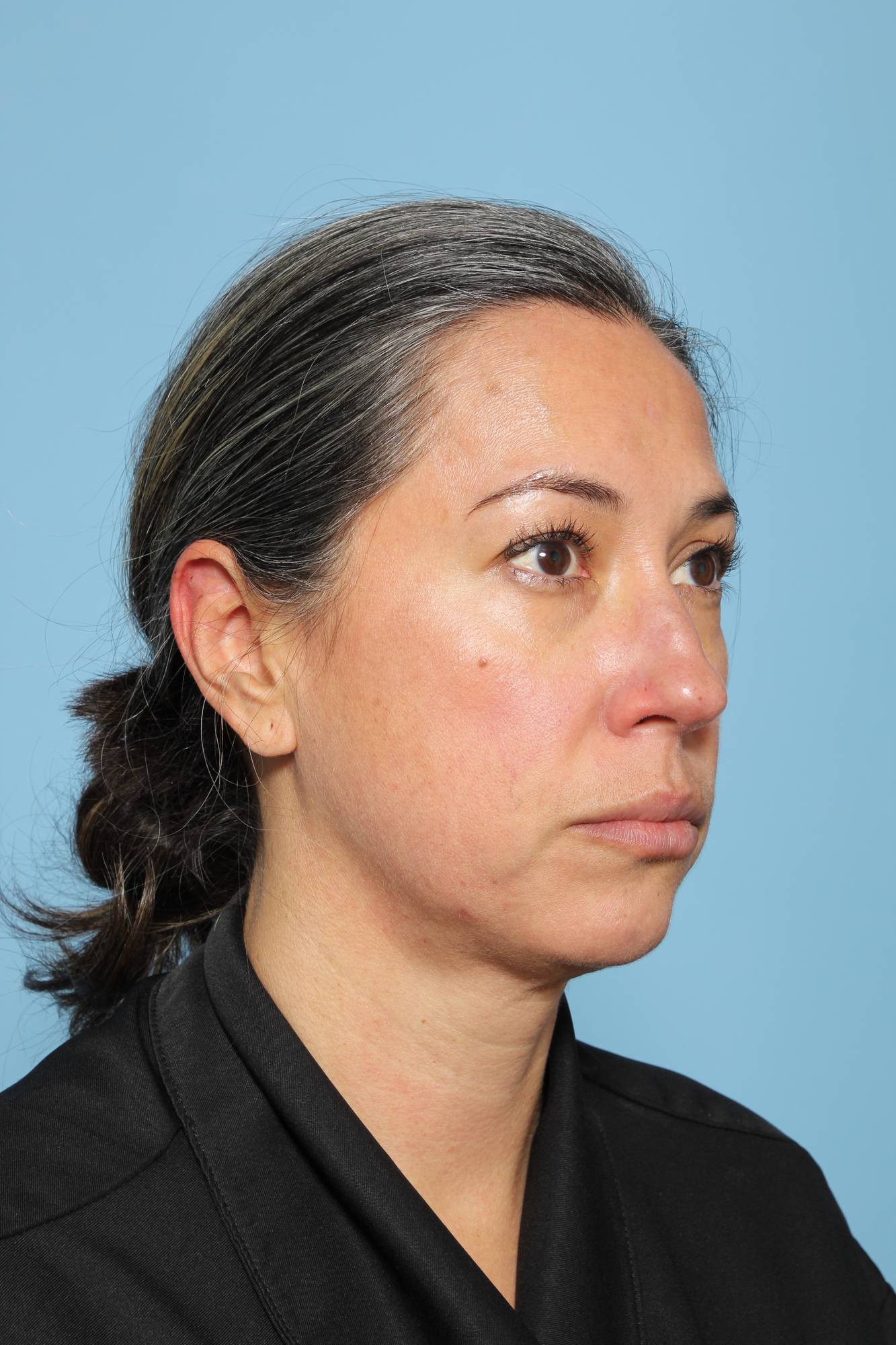 Before & After Image