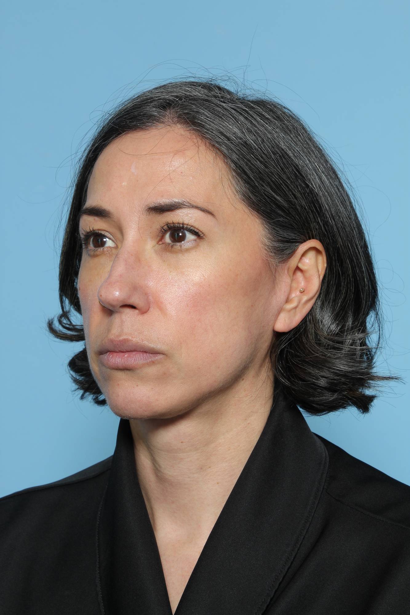 Before & After Image