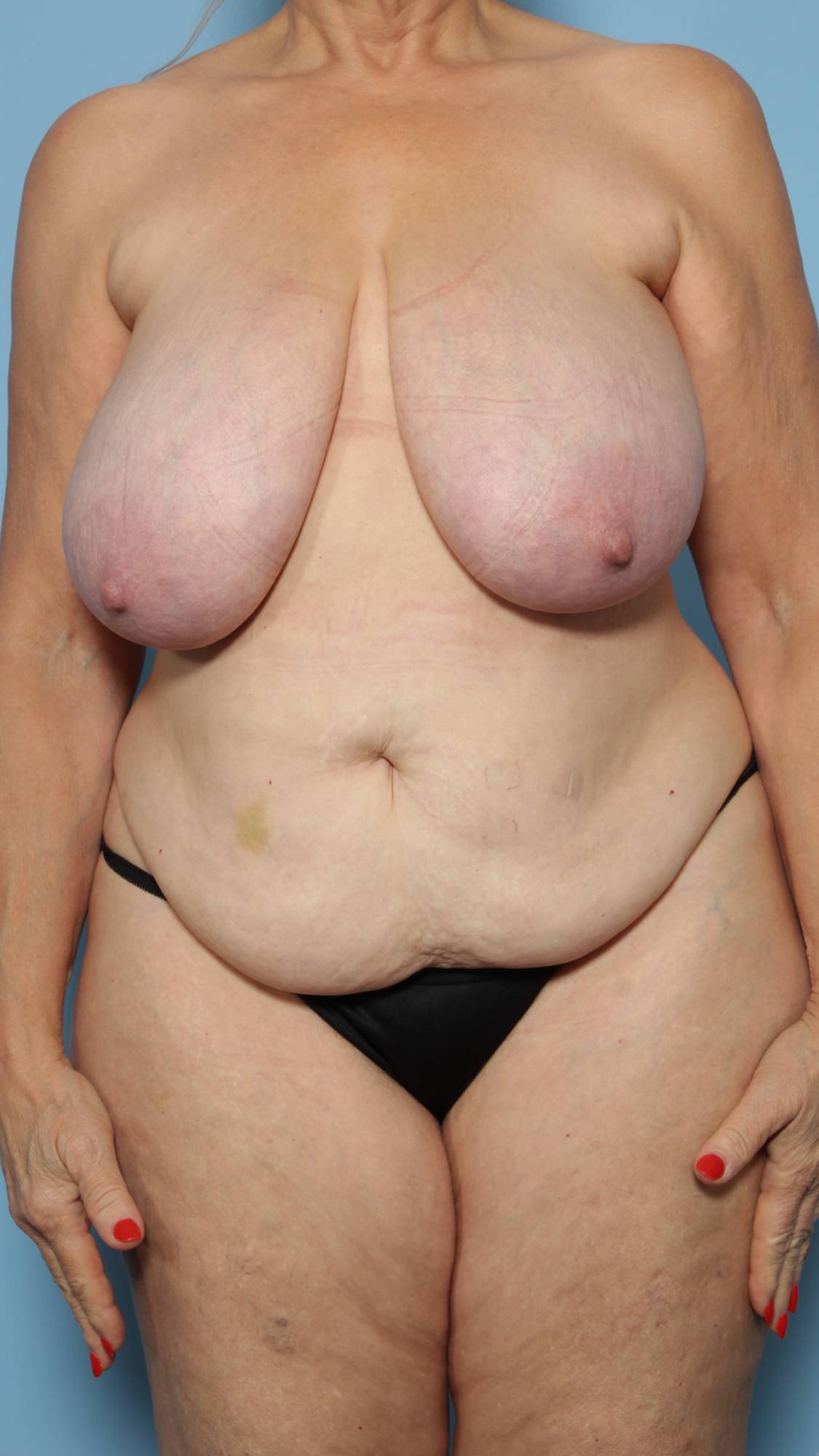 Before & After Image