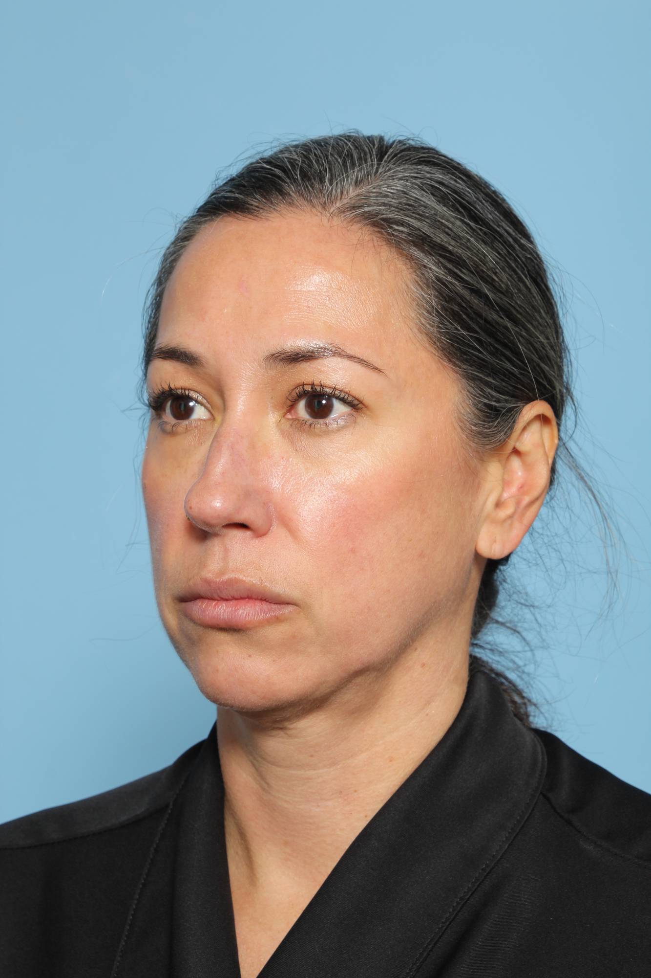 Before & After Image