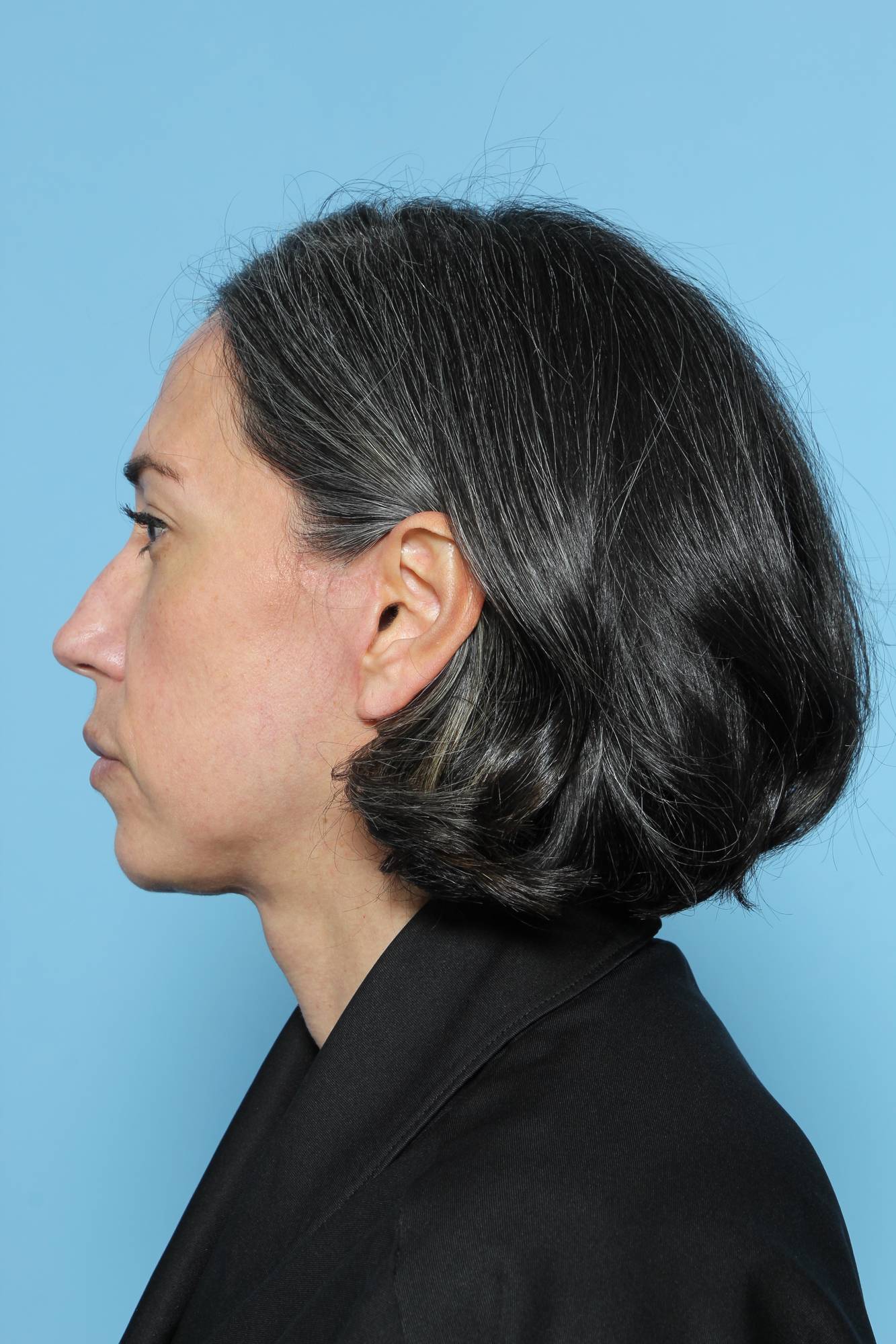 Before & After Image